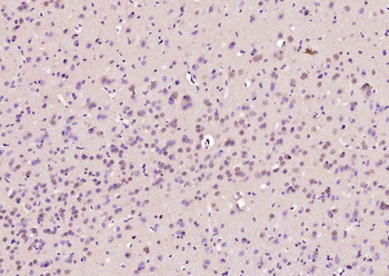 AKIRIN1 Rabbit Polyclonal Antibody