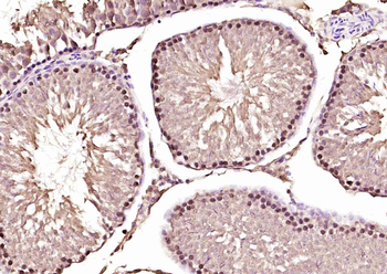 AKIRIN1 Rabbit Polyclonal Antibody