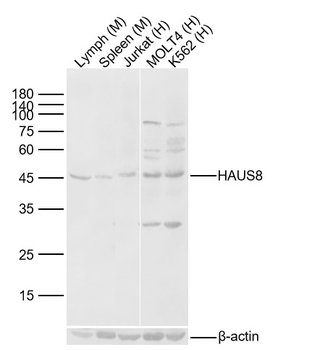 HAUS8 Rabbit Polyclonal Antibody