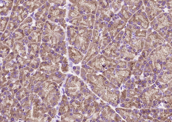 ACPL2 Rabbit Polyclonal Antibody