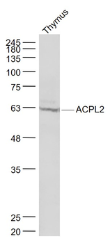 ACPL2 Rabbit Polyclonal Antibody