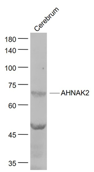 AHNAK2 Rabbit Polyclonal Antibody