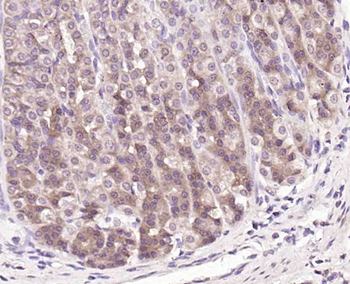 Proteasome 19S 10B Rabbit Polyclonal Antibody