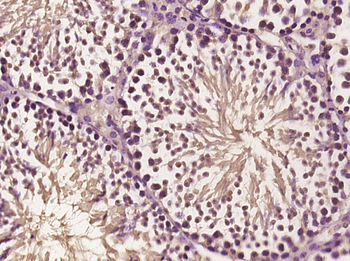 Proteasome 20S alpha 6 Rabbit Polyclonal Antibody