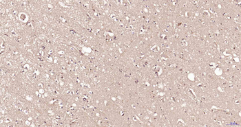 PSMA7 Rabbit Polyclonal Antibody
