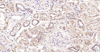 PSMA7 Rabbit Polyclonal Antibody