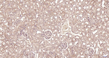 PSMA7 Rabbit Polyclonal Antibody