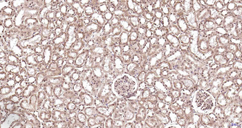 PSMA7 Rabbit Polyclonal Antibody