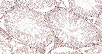 PSMA7 Rabbit Polyclonal Antibody