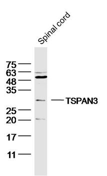 TSPAN3 Rabbit Polyclonal Antibody