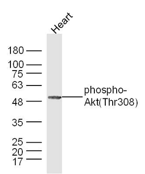 Phospho-Akt (Thr308) Rabbit Polyclonal Antibody