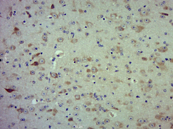 AIM1L Rabbit Polyclonal Antibody