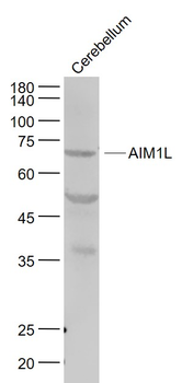 AIM1L Rabbit Polyclonal Antibody