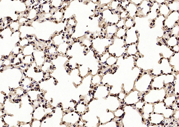 STIP1 Rabbit Polyclonal Antibody