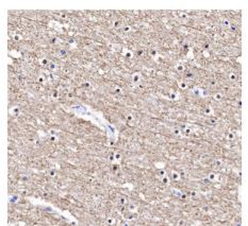 Alpha Tubulin (Acetyl-Lys40) Recombinant Rabbit Monoclonal Antibody