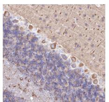 Alpha Tubulin (Acetyl-Lys40) Recombinant Rabbit Monoclonal Antibody