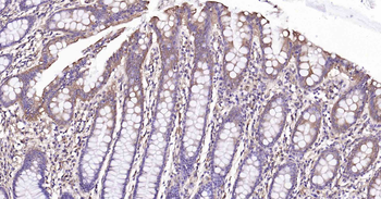 PTP1B Recombinant Rabbit Monoclonal Antibody