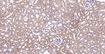 PTP1B Recombinant Rabbit Monoclonal Antibody