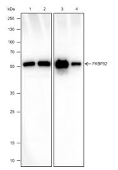 FKBP52 Recombinant Rabbit Monoclonal Antibody