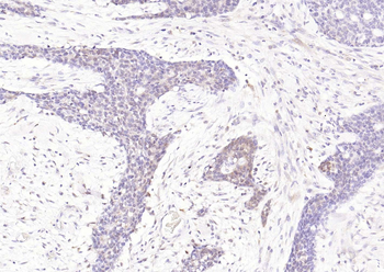 STAT1 Recombinant Rabbit Monoclonal Antibody