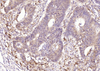 STAT1 Recombinant Rabbit Monoclonal Antibody