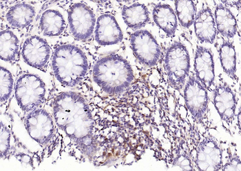 STAT1 Recombinant Rabbit Monoclonal Antibody