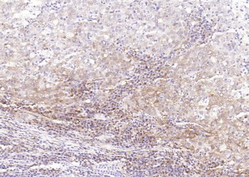 STAT1 Recombinant Rabbit Monoclonal Antibody