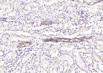 STAT1 Recombinant Rabbit Monoclonal Antibody
