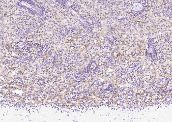 STAT1 Recombinant Rabbit Monoclonal Antibody