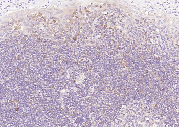 STAT1 Recombinant Rabbit Monoclonal Antibody