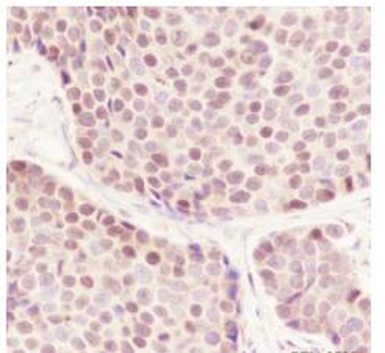 CBX4 Recombinant Rabbit Monoclonal Antibody
