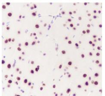 CBX4 Recombinant Rabbit Monoclonal Antibody