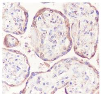 LRP1 Recombinant Rabbit Monoclonal Antibody