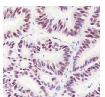 AKT1 / AKT2 / AKT3 Recombinant Rabbit Monoclonal Antibody