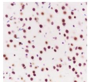AKT1 / AKT2 / AKT3 Recombinant Rabbit Monoclonal Antibody