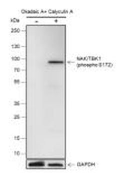 Phospho-TBK1 (Ser172) Recombinant Rabbit Monoclonal Antibody