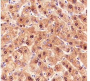 ADK Recombinant Rabbit Monoclonal Antibody