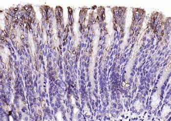 Claudin 18.2 Recombinant Rabbit Monoclonal Antibody