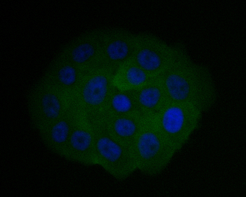 CHMP2B Recombinant Rabbit Monoclonal Antibody