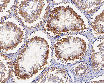 CHMP2B Recombinant Rabbit Monoclonal Antibody