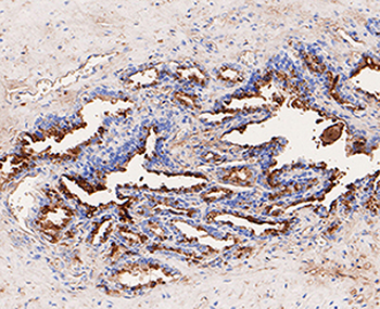 GCDFP15 Recombinant Rabbit Monoclonal Antibody