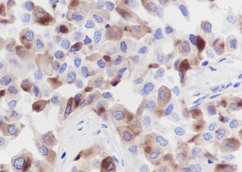 GCDFP15 Recombinant Rabbit Monoclonal Antibody