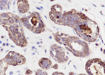 GCDFP15 Recombinant Rabbit Monoclonal Antibody