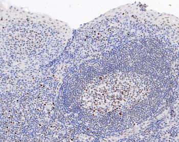 Phospho-V-Myb+C-Myb (Ser11) Recombinant Rabbit Monoclonal Antibody
