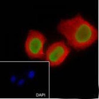 Histone H4 (acetyl K16) Recombinant Rabbit Monoclonal Antibody
