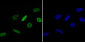 Histone H4 (acetyl K16) Recombinant Rabbit Monoclonal Antibody