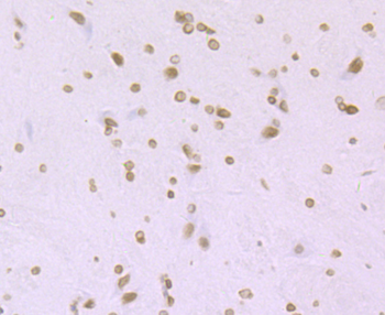 Histone H4 (acetyl K16) Recombinant Rabbit Monoclonal Antibody