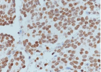Histone H4 (acetyl K16) Recombinant Rabbit Monoclonal Antibody