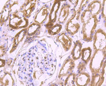 PSMB8 Recombinant Rabbit Monoclonal Antibody