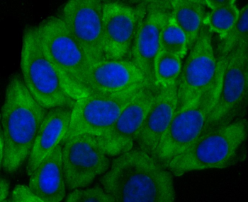 Growth hormone receptor Recombinant Rabbit Monoclonal Antibody